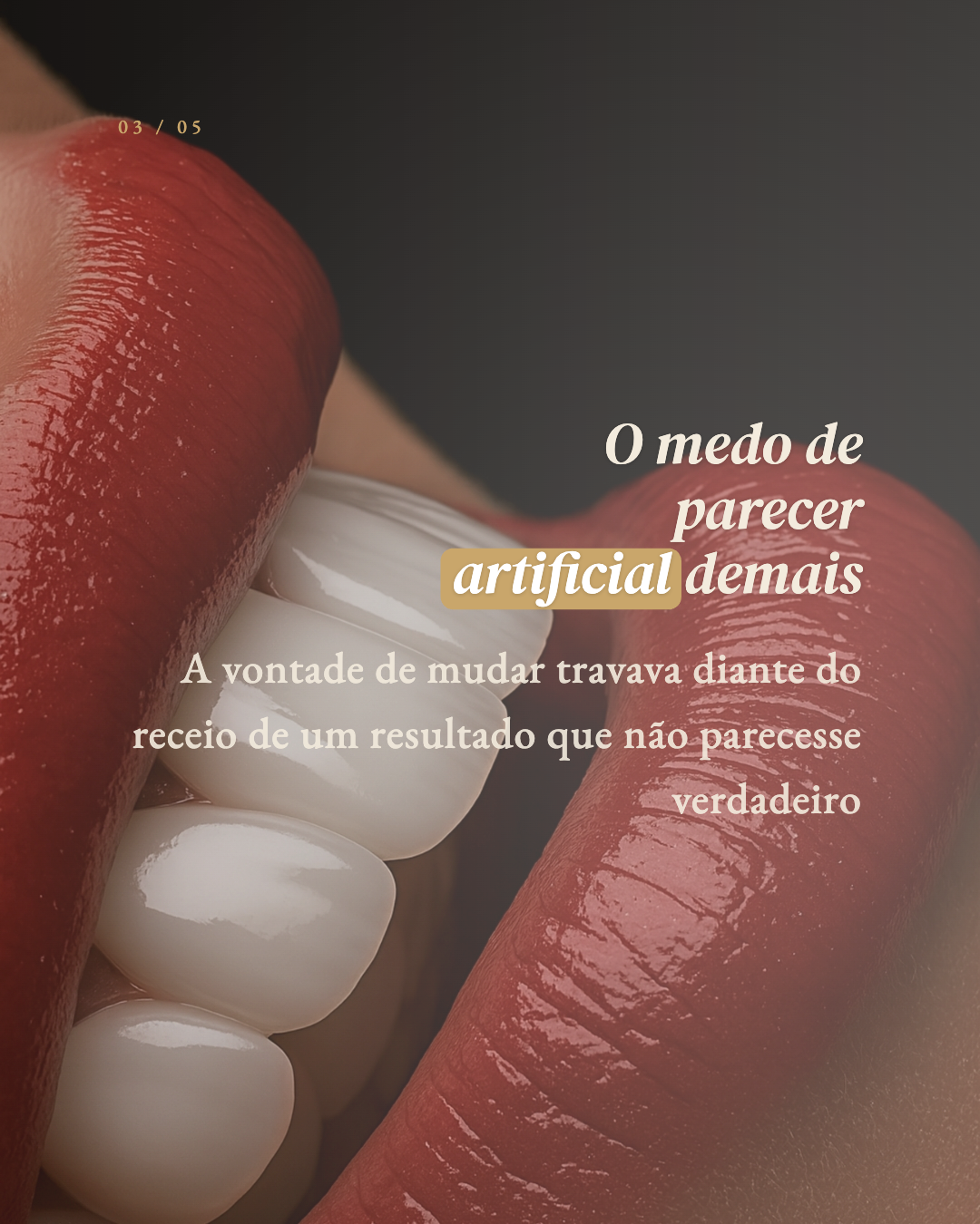 Exemplo de carrossel 10