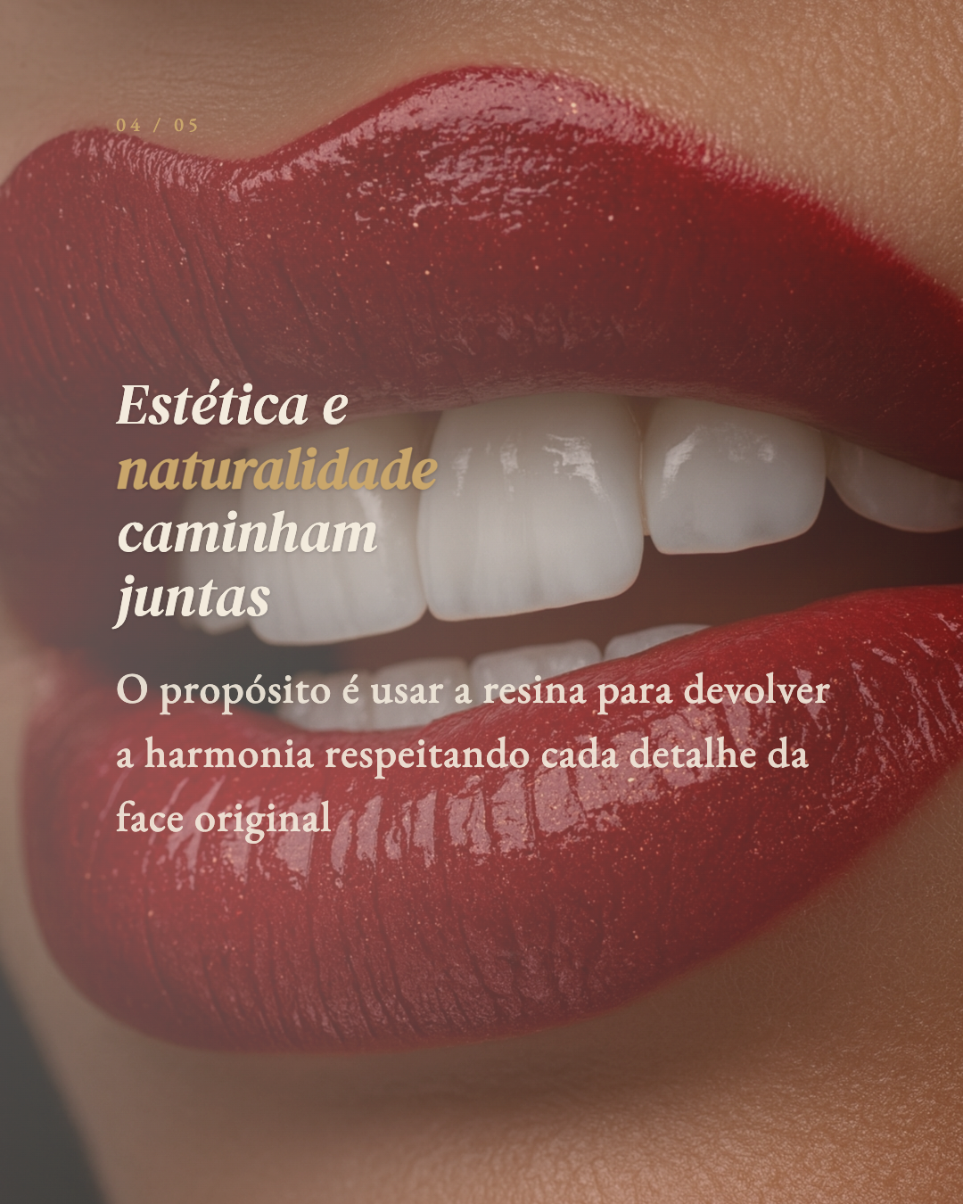 Exemplo de carrossel 11