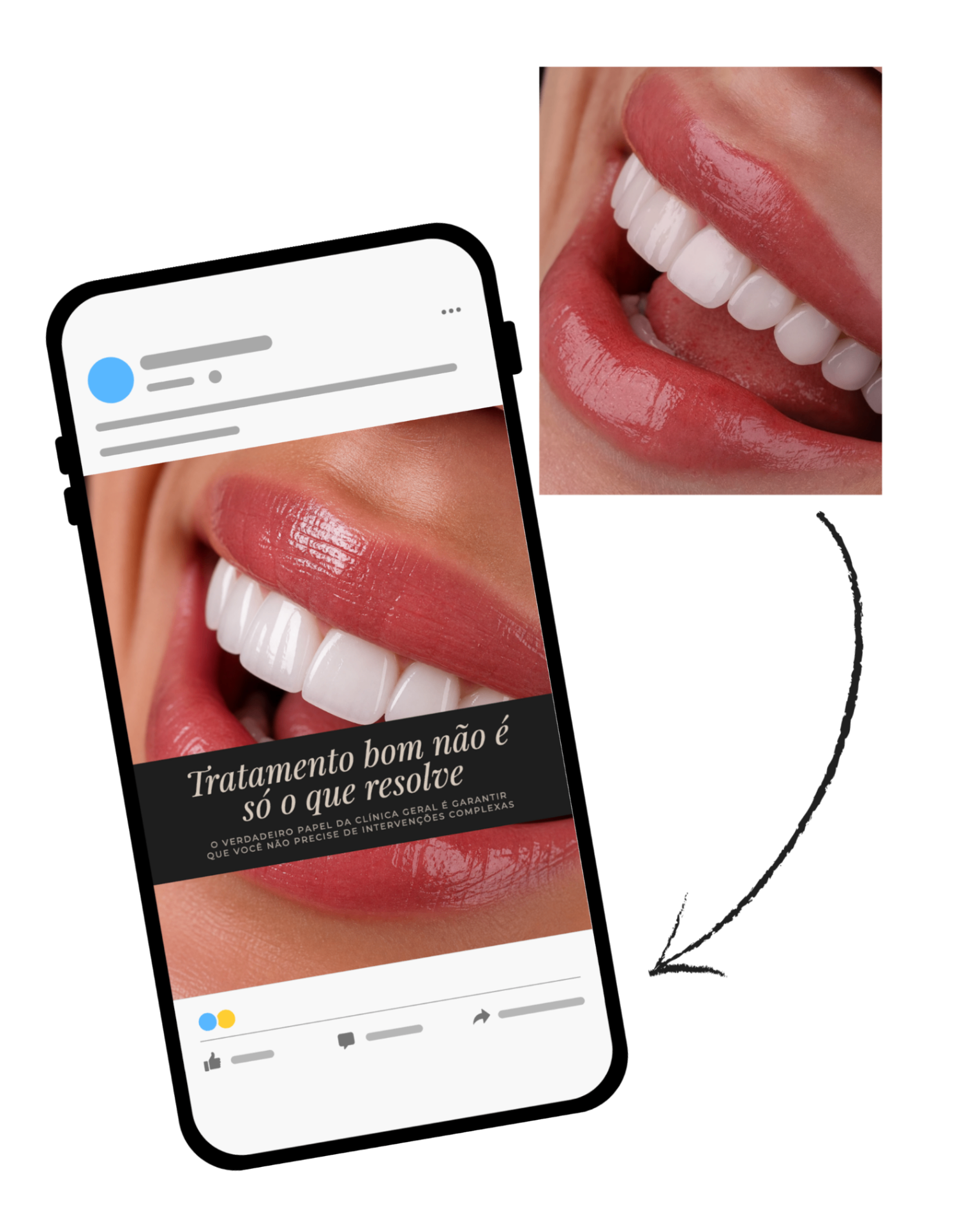 Mockup com fotos do banco Post Pra Dentista